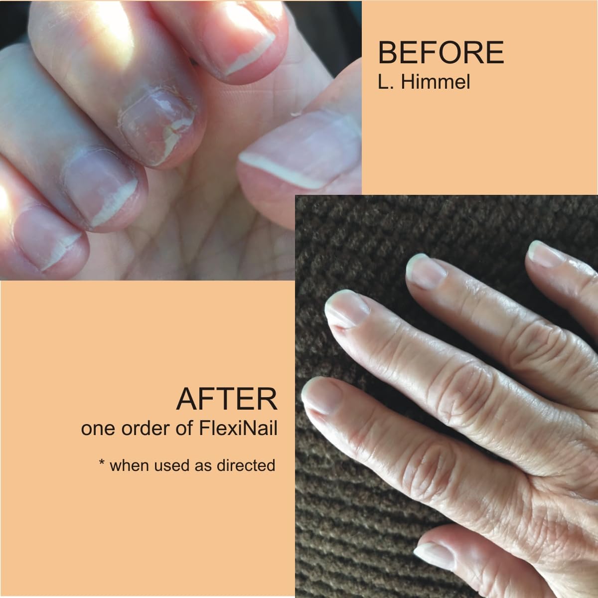 FlexiNail weak nails before and after visuals illustrating repair possibilities.