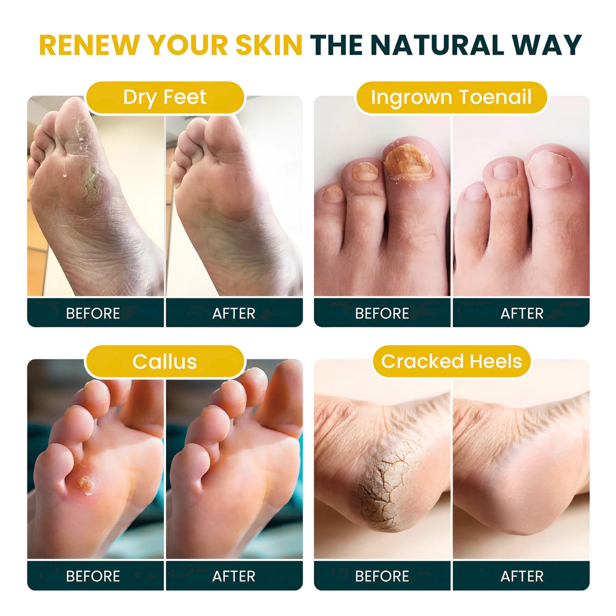 Foot Cure Citrus Detox epsom salts pour demonstrates relaxing soak and soothing foot muscles.