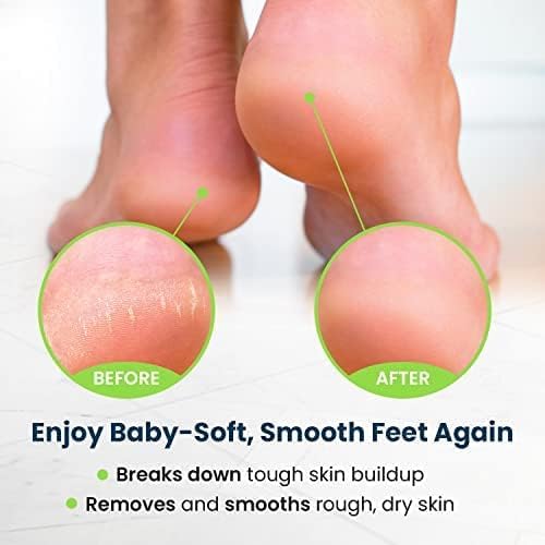 Foot Cure ivory 4-piece set displayed in box