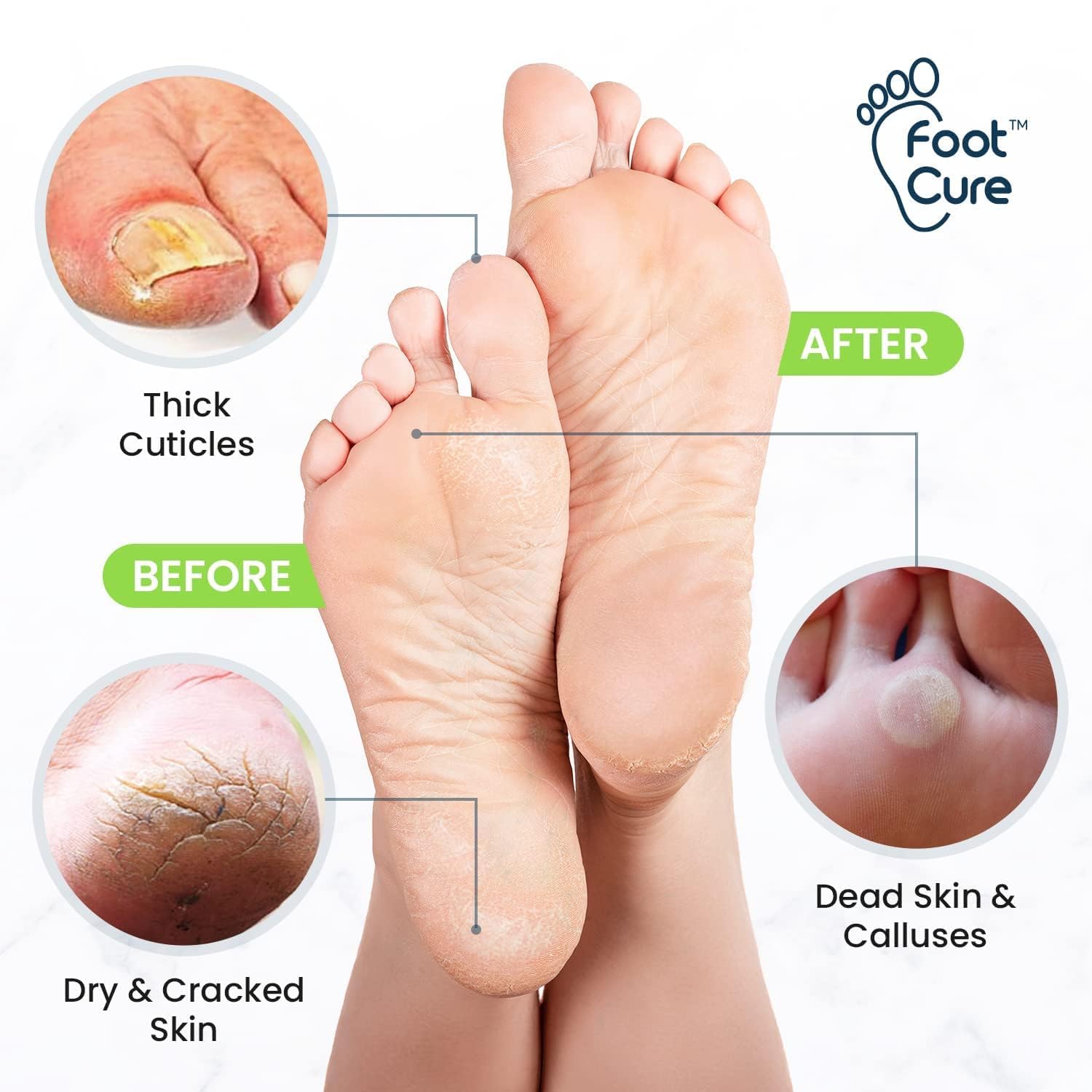 Foot Cure Made in USA packaging front view