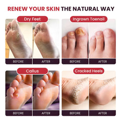 FOOT CURE natural-ingredients-visual showcases all-natural formula for gentle foot care.