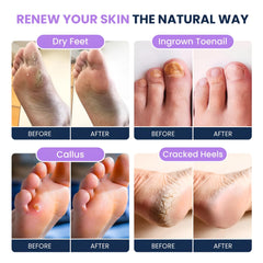Foot Cure soaking feet in a warm, spa-like bath.