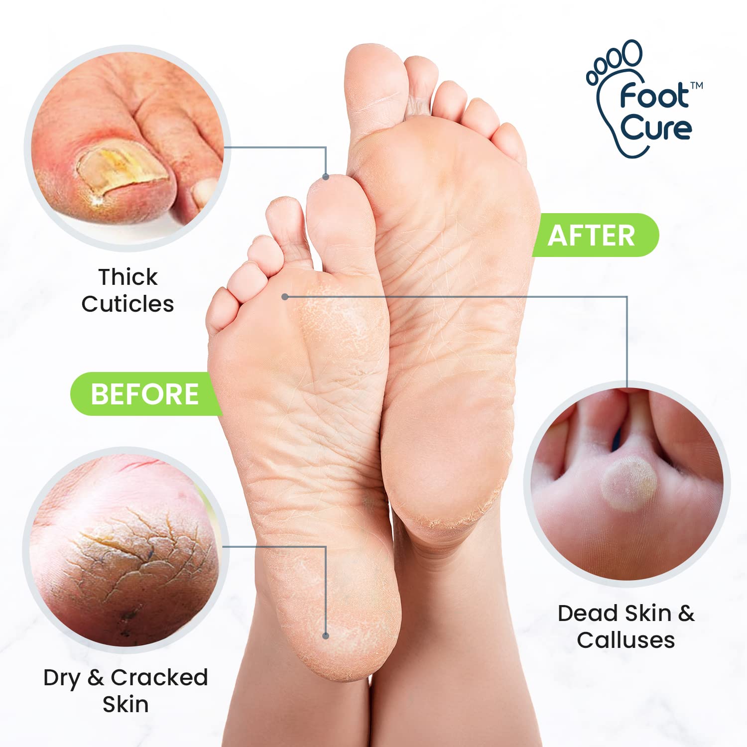 Foot Cure Tea Tree Foot Soak ingredients closeup shows natural oils for nurturing feet.