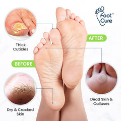 Foot Cure Tea Tree Foot Soak ingredients closeup shows natural oils for nurturing feet.