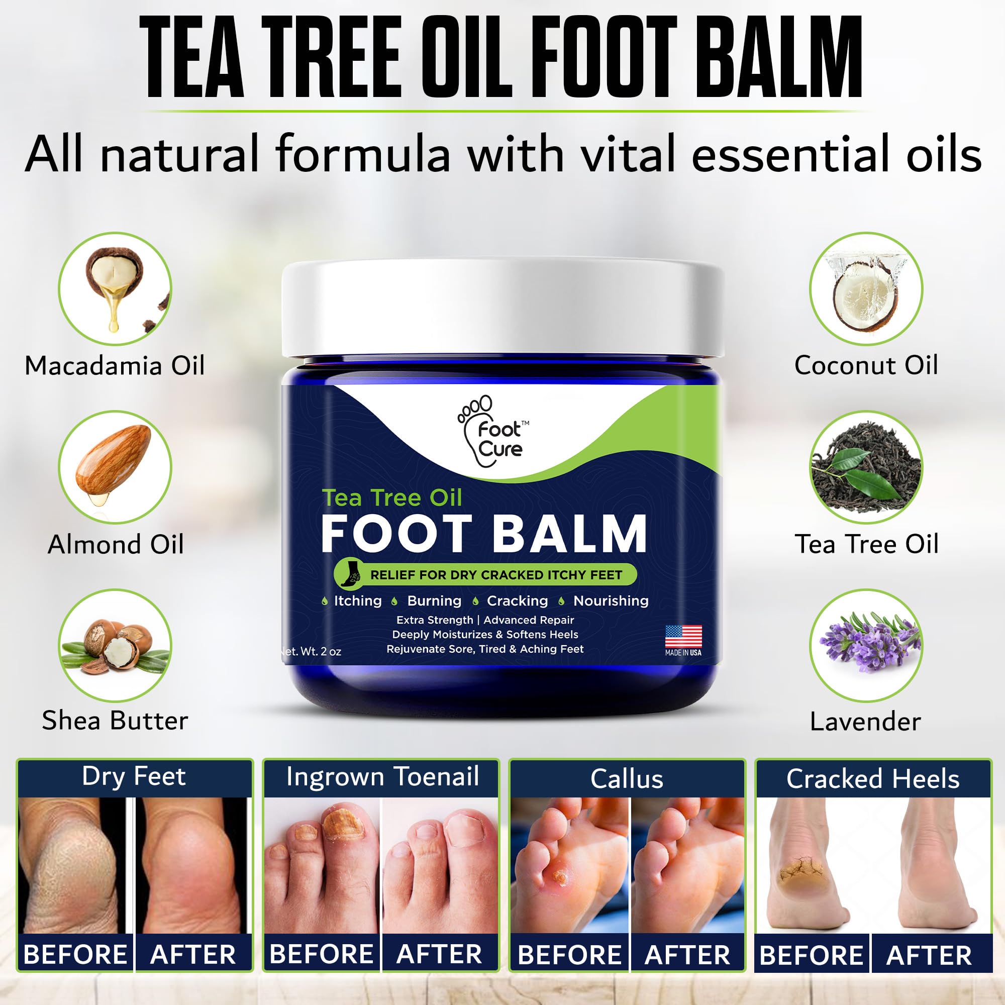 FOOT CURE Tea Tree Oil Balm rejuvenates tired feet.