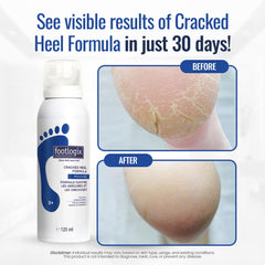 FOOTLOGIX Cracked Heel Formula application close-up displays creamy texture ideal for daily foot care.