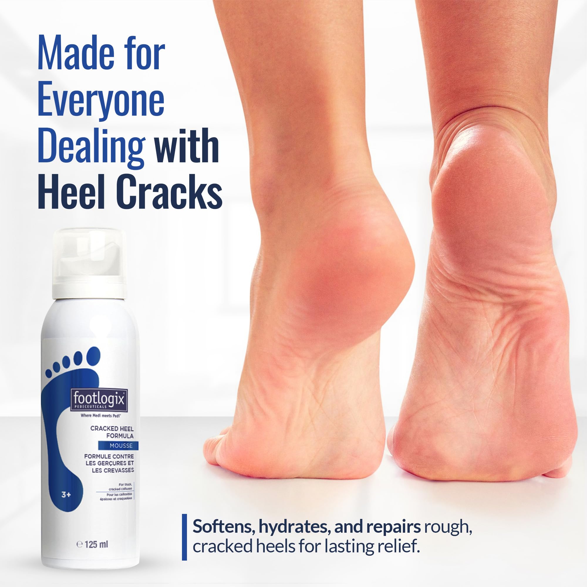 FOOTLOGIX Cracked Heel Formula dispensing action shows easy, mess-free hydration.