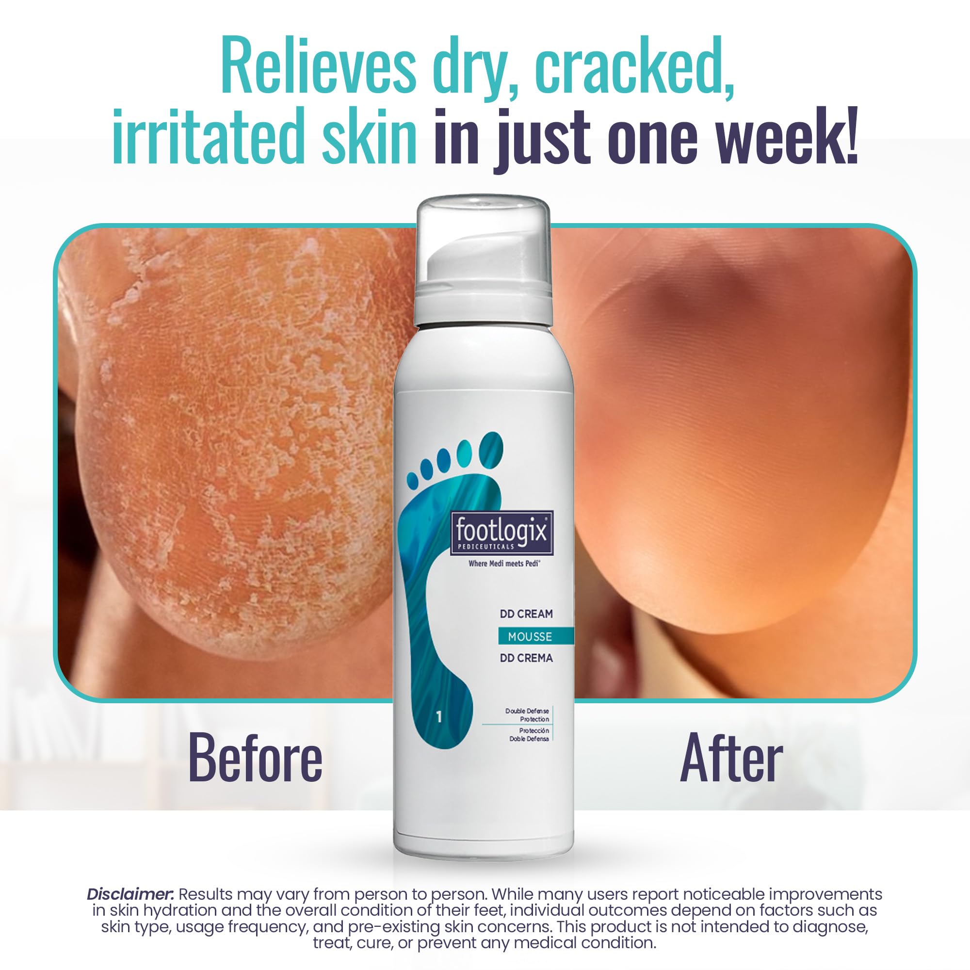 Footlogix DD Cream Mousse nightcare routine visual suggests overnight hydration.