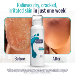 Footlogix DD Cream Mousse nightcare routine visual suggests overnight hydration.