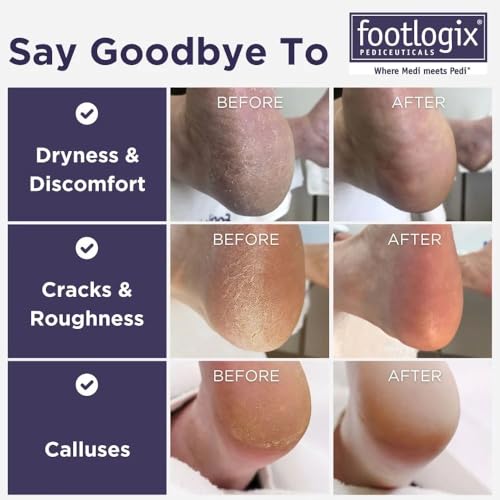 Footlogix double-sided foot file showing coarse and fine grits for effective smoothing.