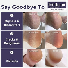 Footlogix double-sided foot file showing coarse and fine grits for effective smoothing.