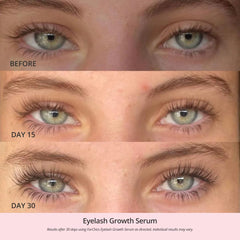 ForChics applicator tip gliding on lashes enables precise daily use