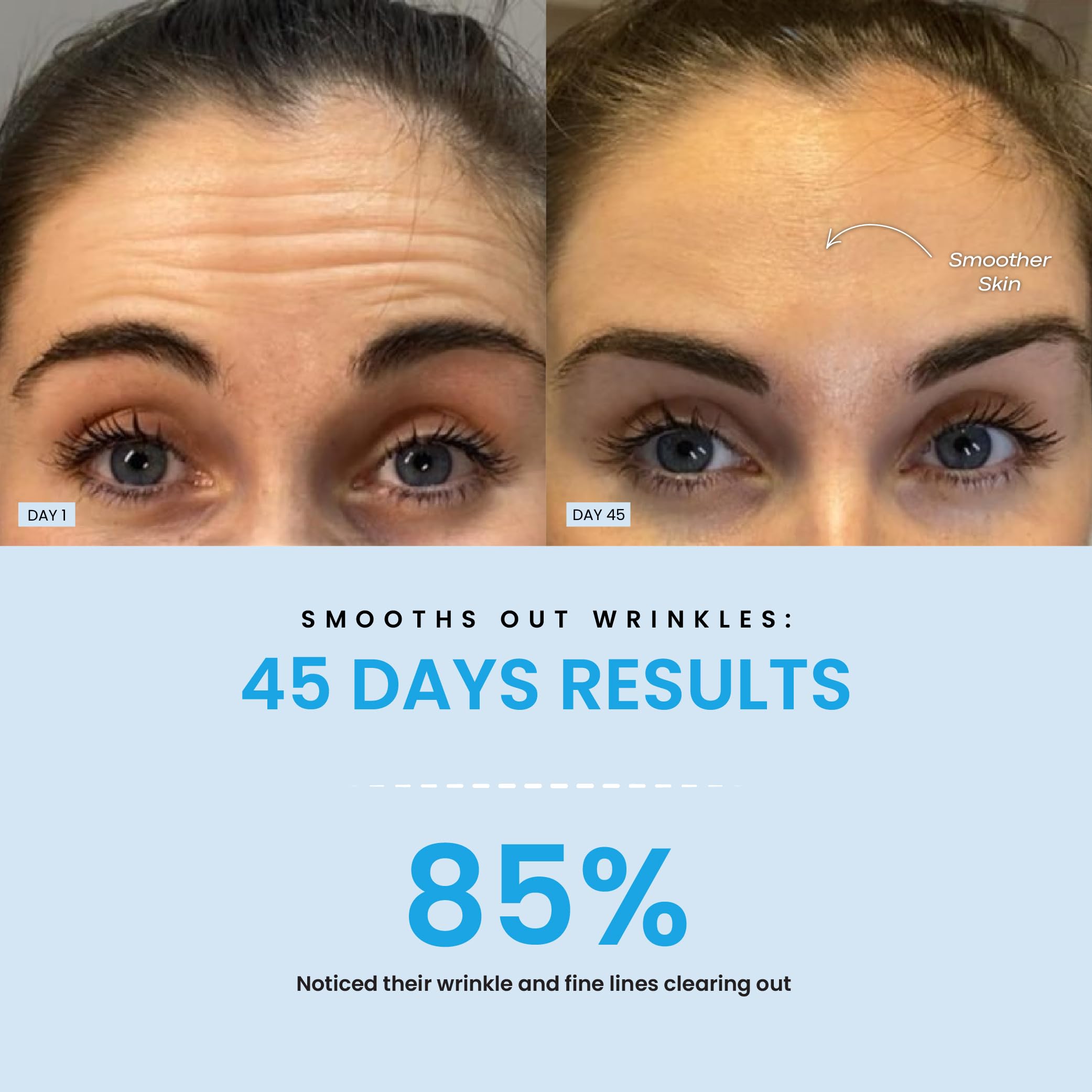 Forchics LiftLab wrinkle-care view emphasizes line smoothing potential.