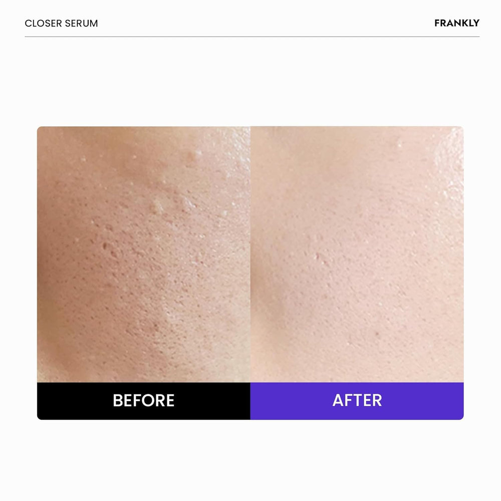 FRANKLY Closer Serum vegan collagen icon emphasizes cruelty-free nourishment.