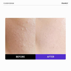 FRANKLY Closer Serum vegan collagen icon emphasizes cruelty-free nourishment.