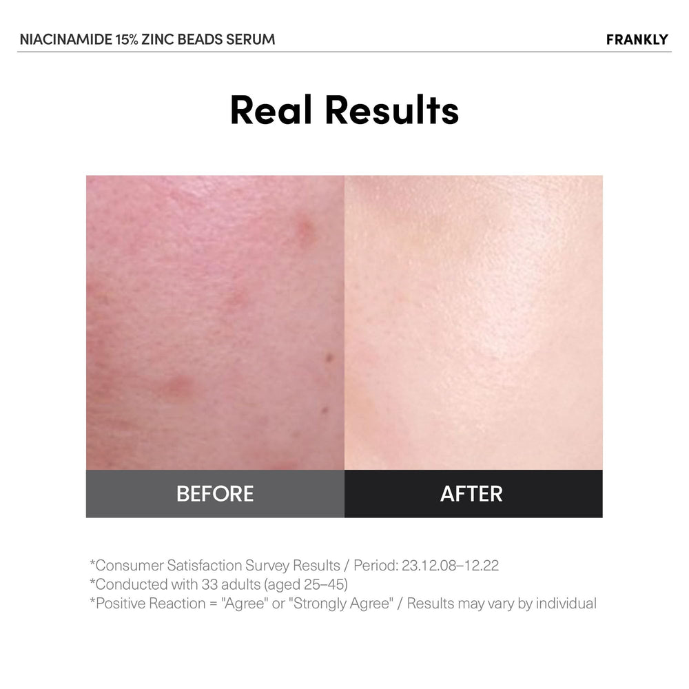 FRANKLY Niacinamide beads closeup showing bursting beads delivering fresh Niacinamide.