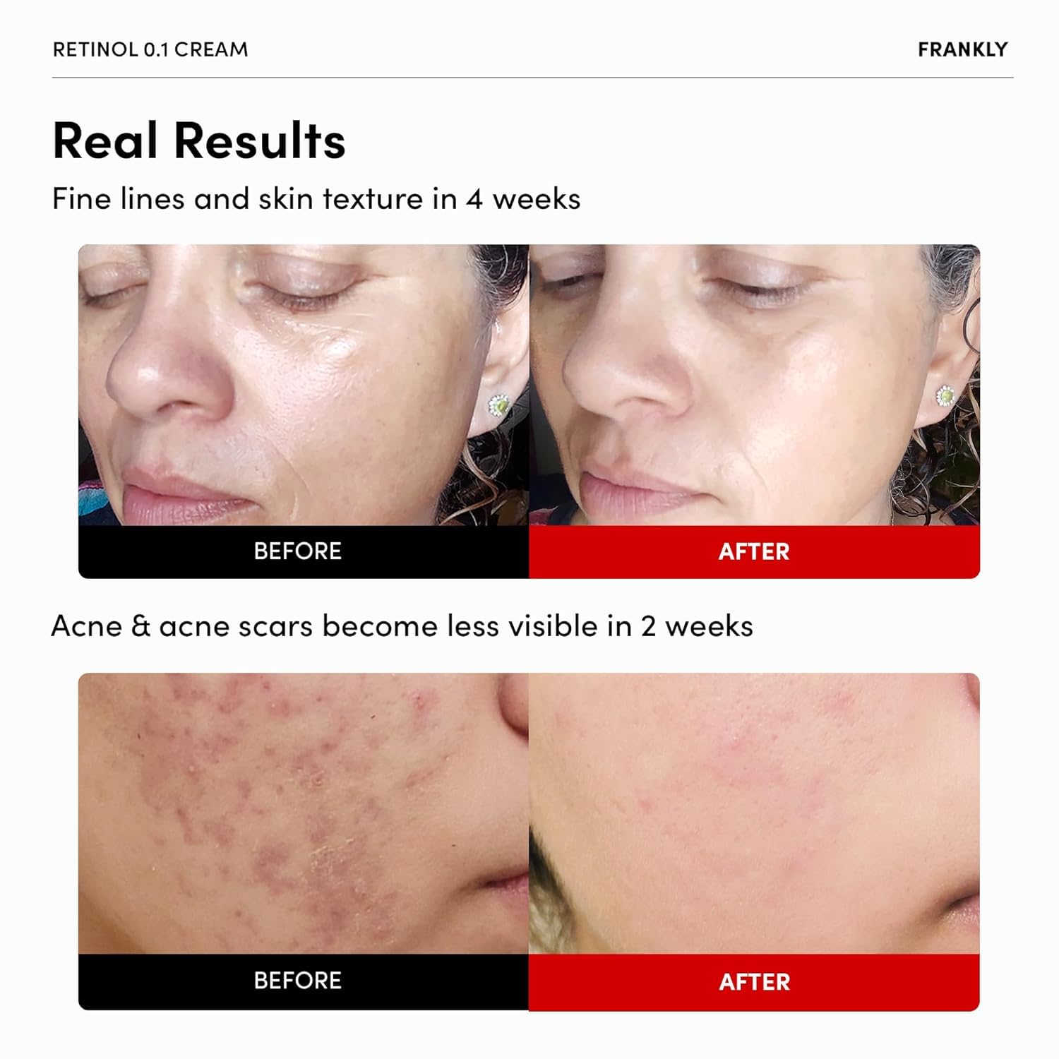 FRANKLY retinol jar close-up shows smooth texture and payoff.