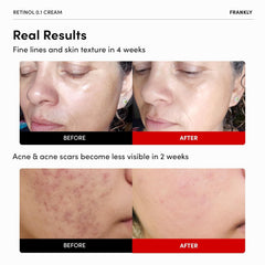 FRANKLY retinol jar close-up shows smooth texture and payoff.