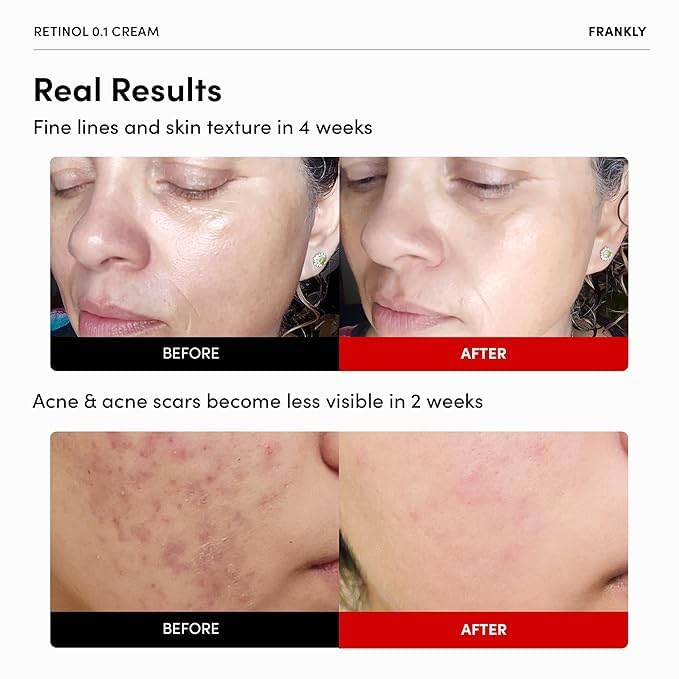 FRANKLY Retinol 0.1 Cream texture showcasing its hydration.