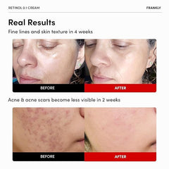 FRANKLY retinol pump bottle at night routine ready for easy application