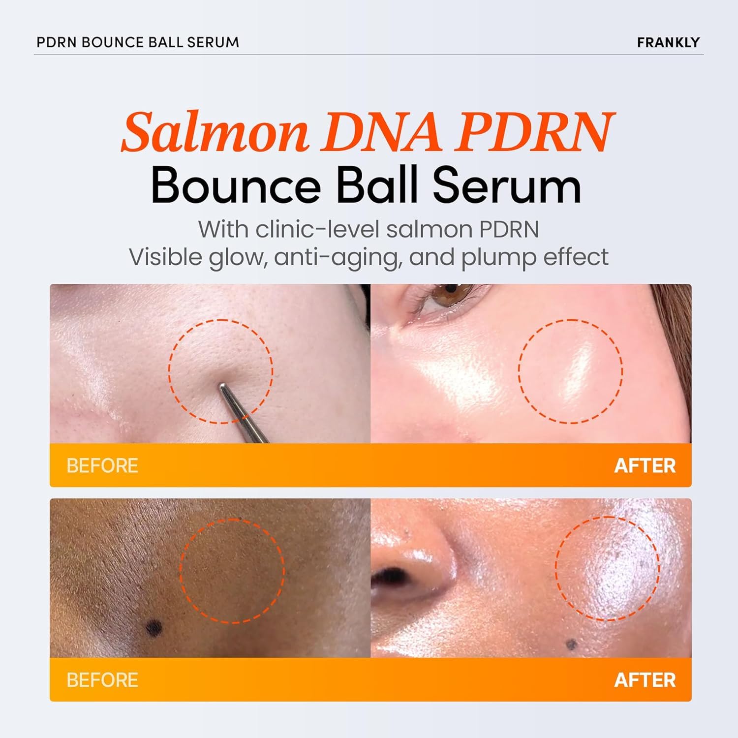 FRANKLY Salmon PDRN Bounce Ball activation shows shake-to-release microdosed actives for deep nourishment.