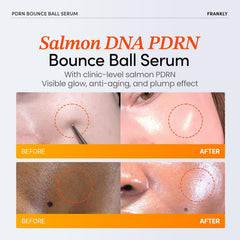 FRANKLY Salmon PDRN Bounce Ball activation shows shake-to-release microdosed actives for deep nourishment.