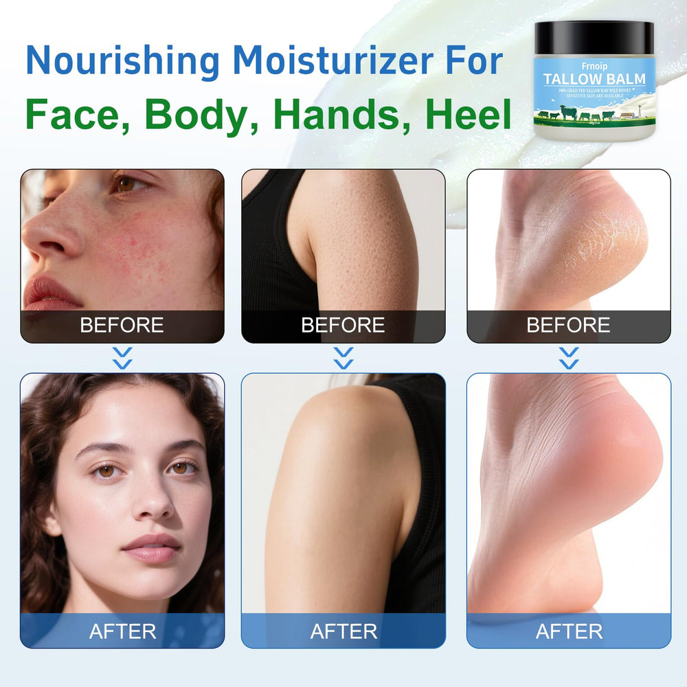 Frnoip 4-pack travel size jars shown for convenient winter skincare on the go.