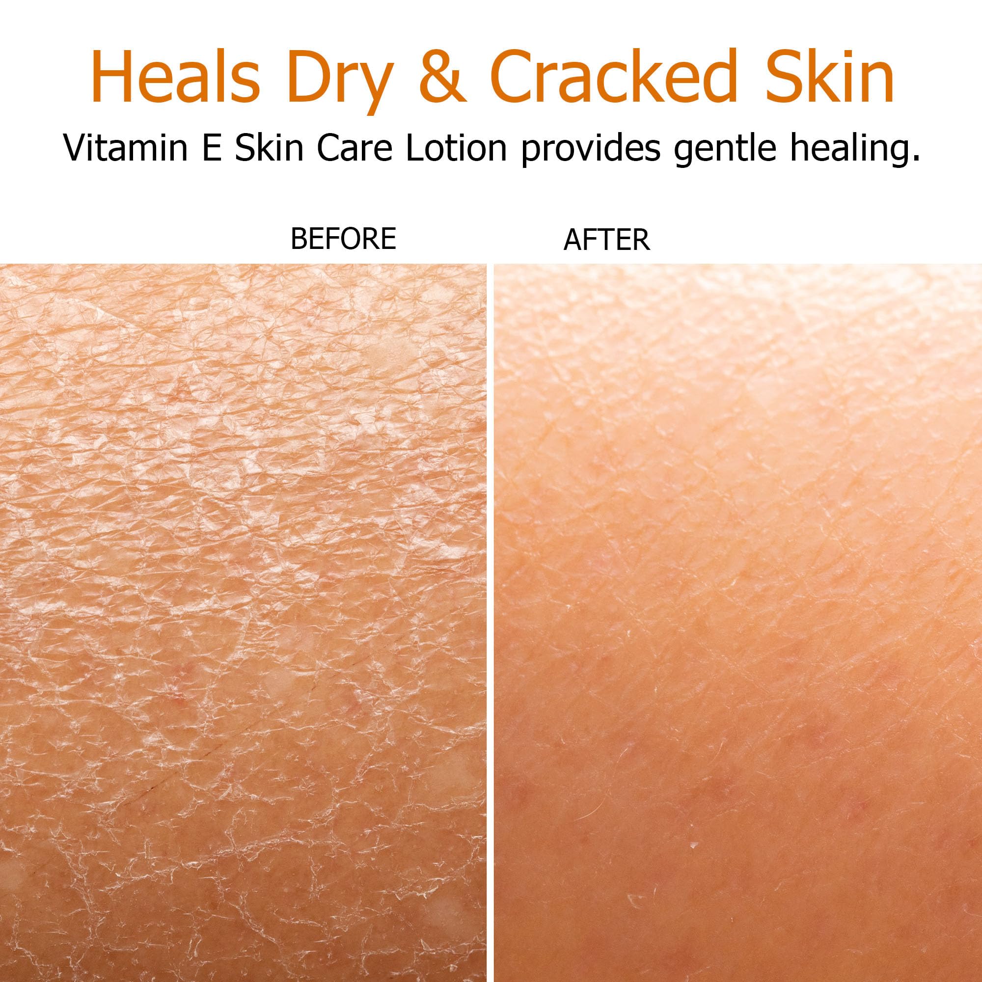 Fruit of the Earth Vitamin E Lotion packaging close-up highlights value in a two-pack.