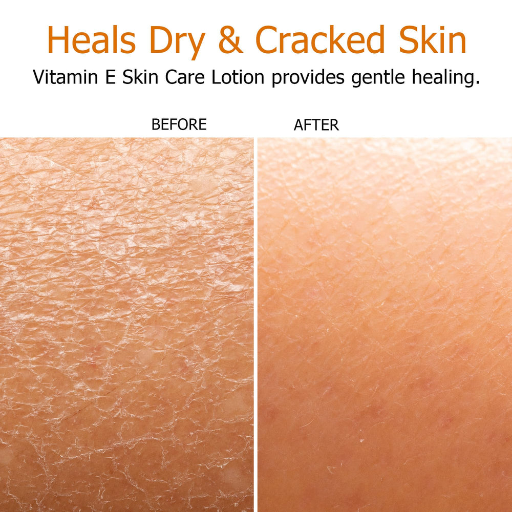 Fruit of the Earth Vitamin E Lotion packaging close-up highlights value in a two-pack.