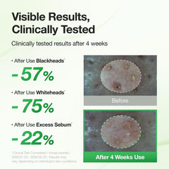 FULLY application on nose and T-zone targeting blackheads gently