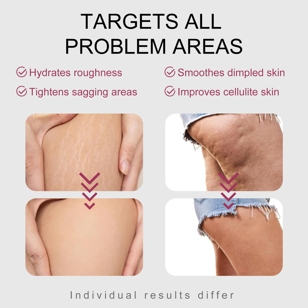 Fuputo B-TIGHT lift-elasticity view hints at firmer-looking skin.