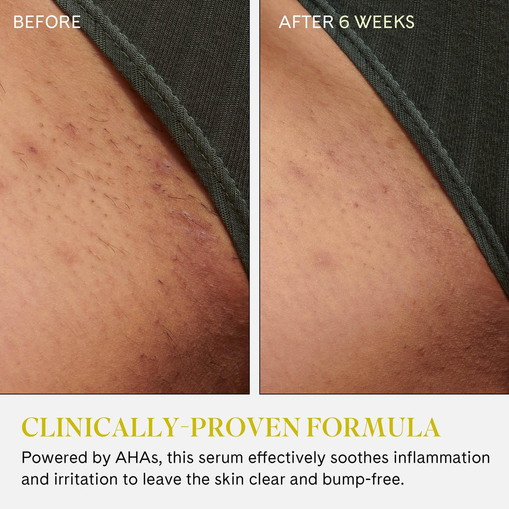 Fur Ingrown Eliminator Serum Rollerball AHAs and BHAs formulation shown for exfoliating benefits.