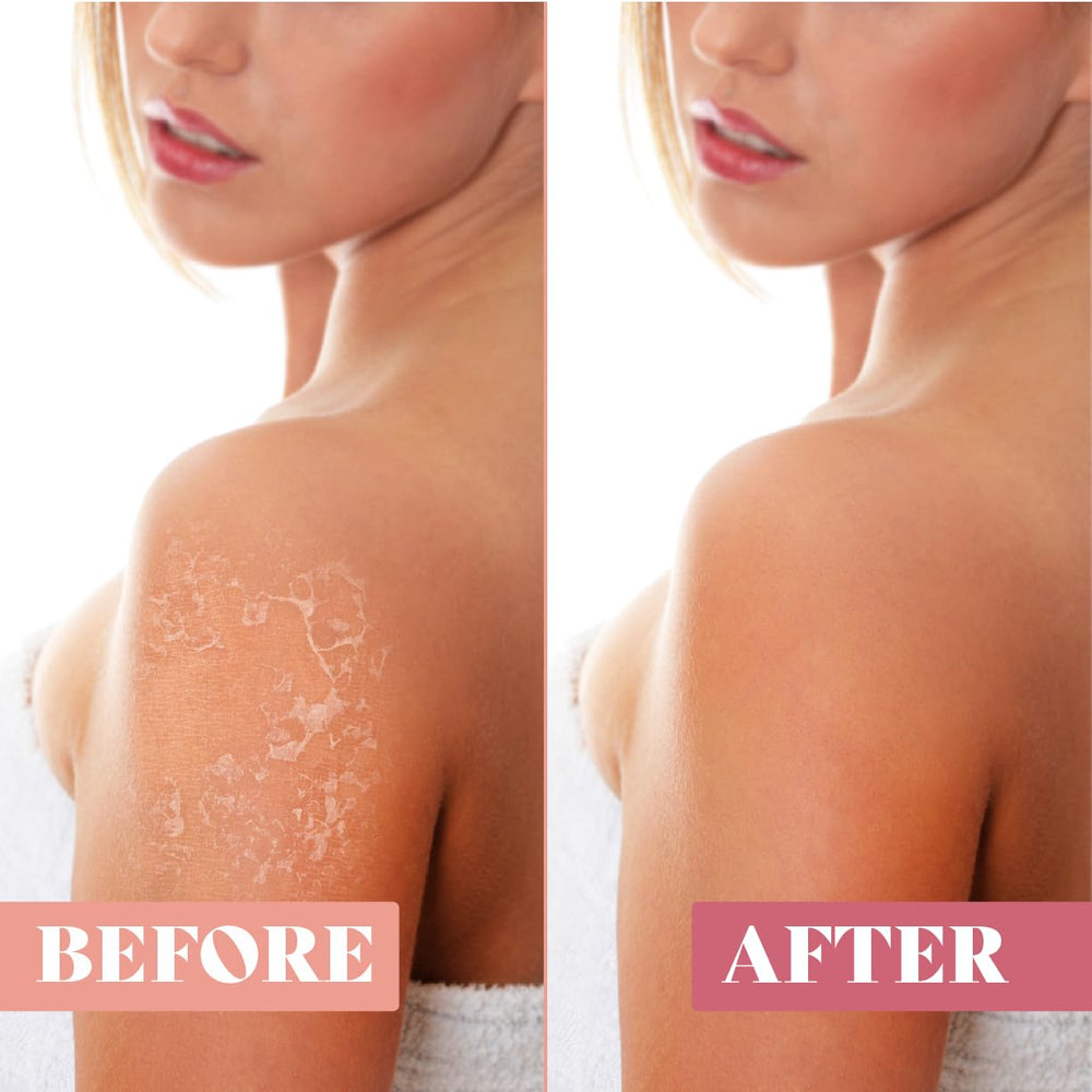 FURSINA exfoliating glove in shower demonstrates spa-like routine.