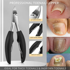 Fuwddy pedicure knife with three blades close-up for versatile nail care