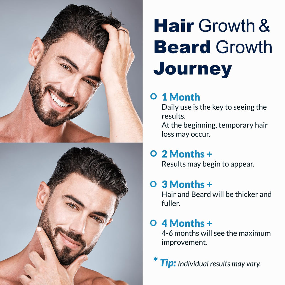 FUZYAT Minoxidil spray also supports beard growth in applicable use cases.