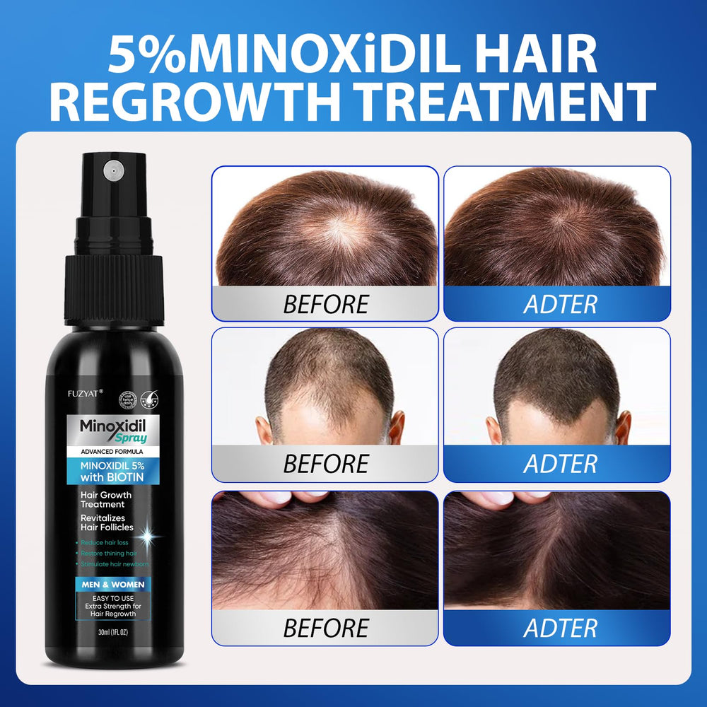 FUZYAT minoxidil spray ingredients Biotin Niacinamide for scalp nourishment