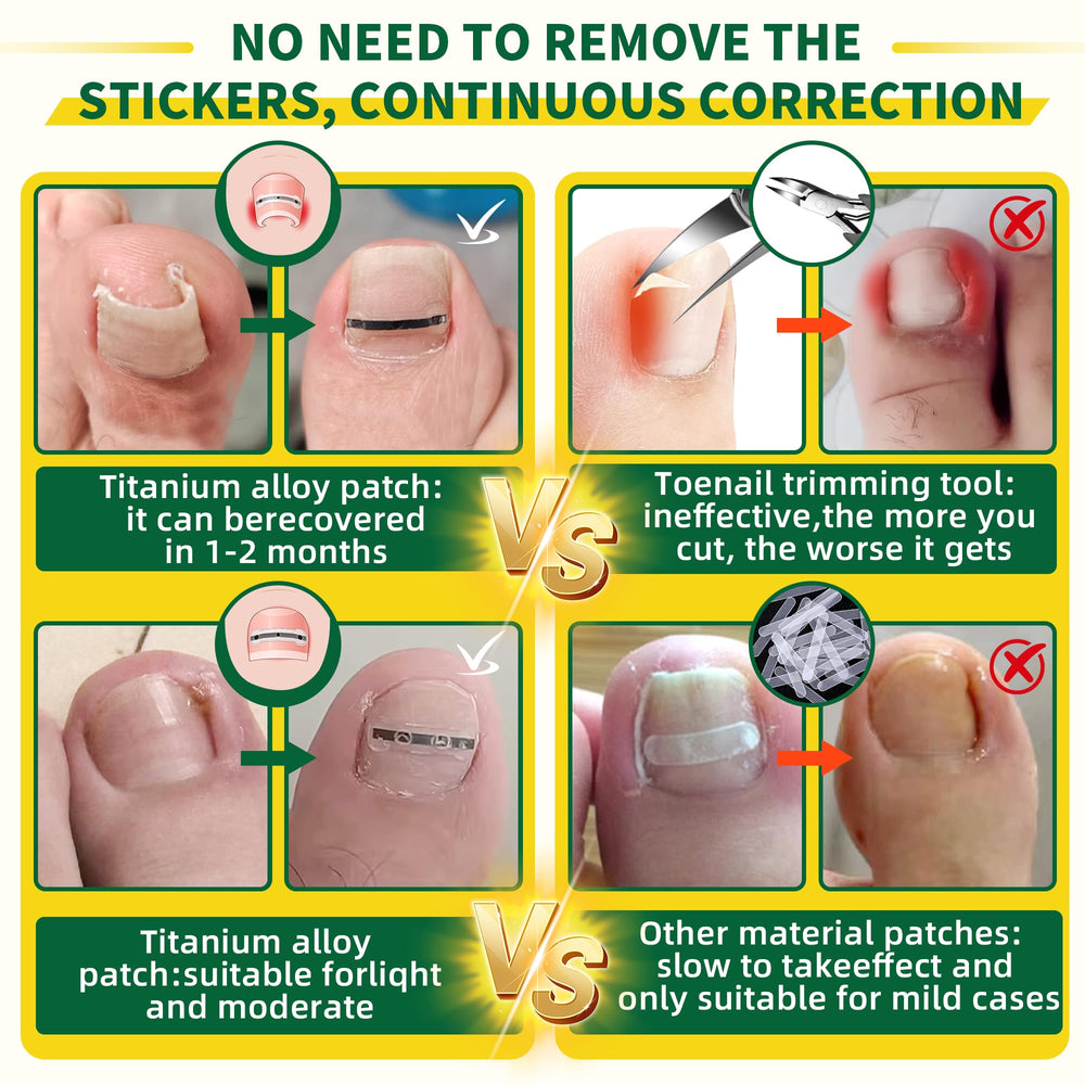 Fuzzycare easy application quick sticking strip demonstrates clean glue-free use