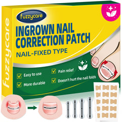 Fuzzycare large-size titanium ingrown toenail kit packaging for at home relief