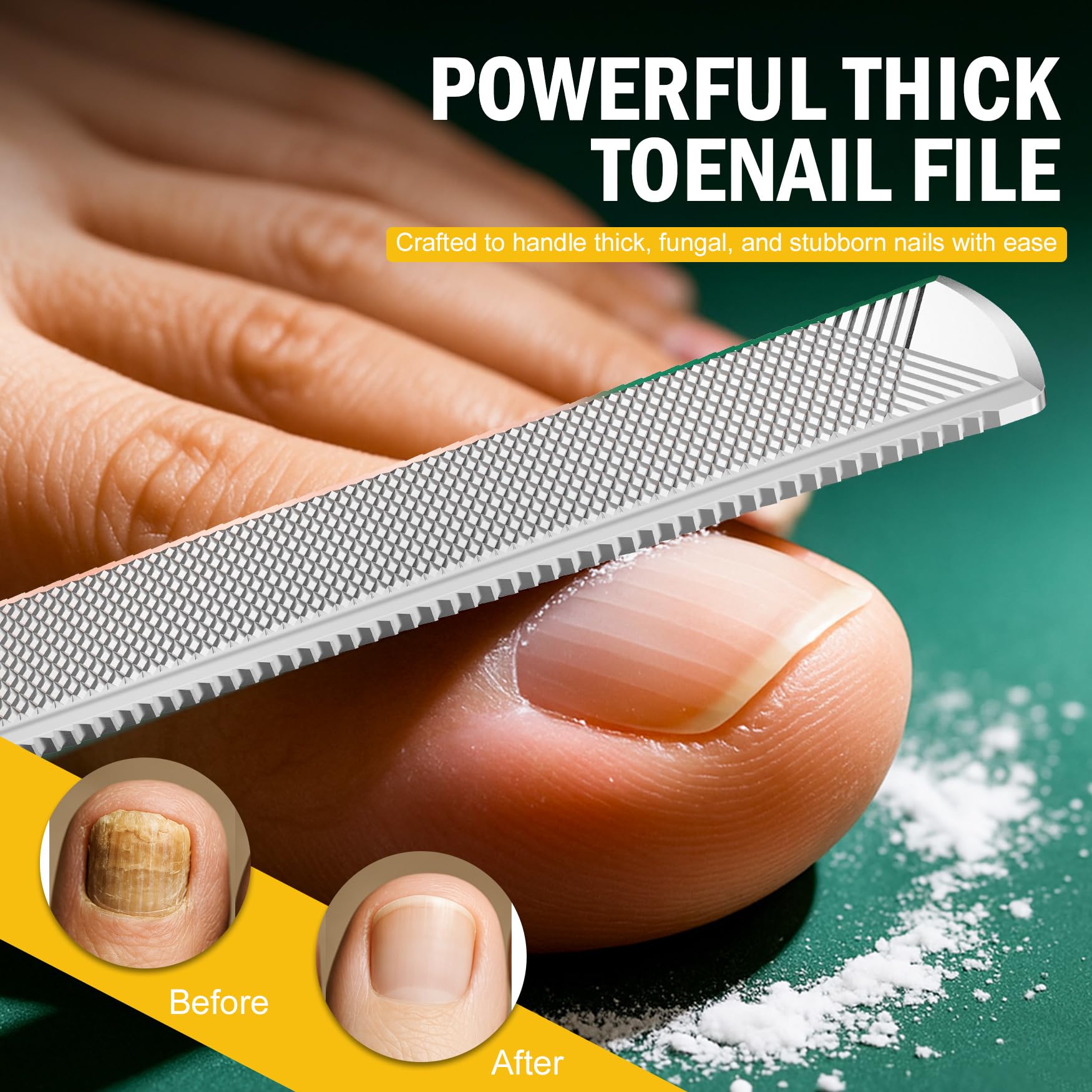 FVION toenail lifter ingrown-relief angled view aids gentle lifting and cleaning.