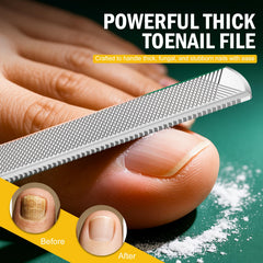 FVION toenail lifter ingrown-relief angled view aids gentle lifting and cleaning.