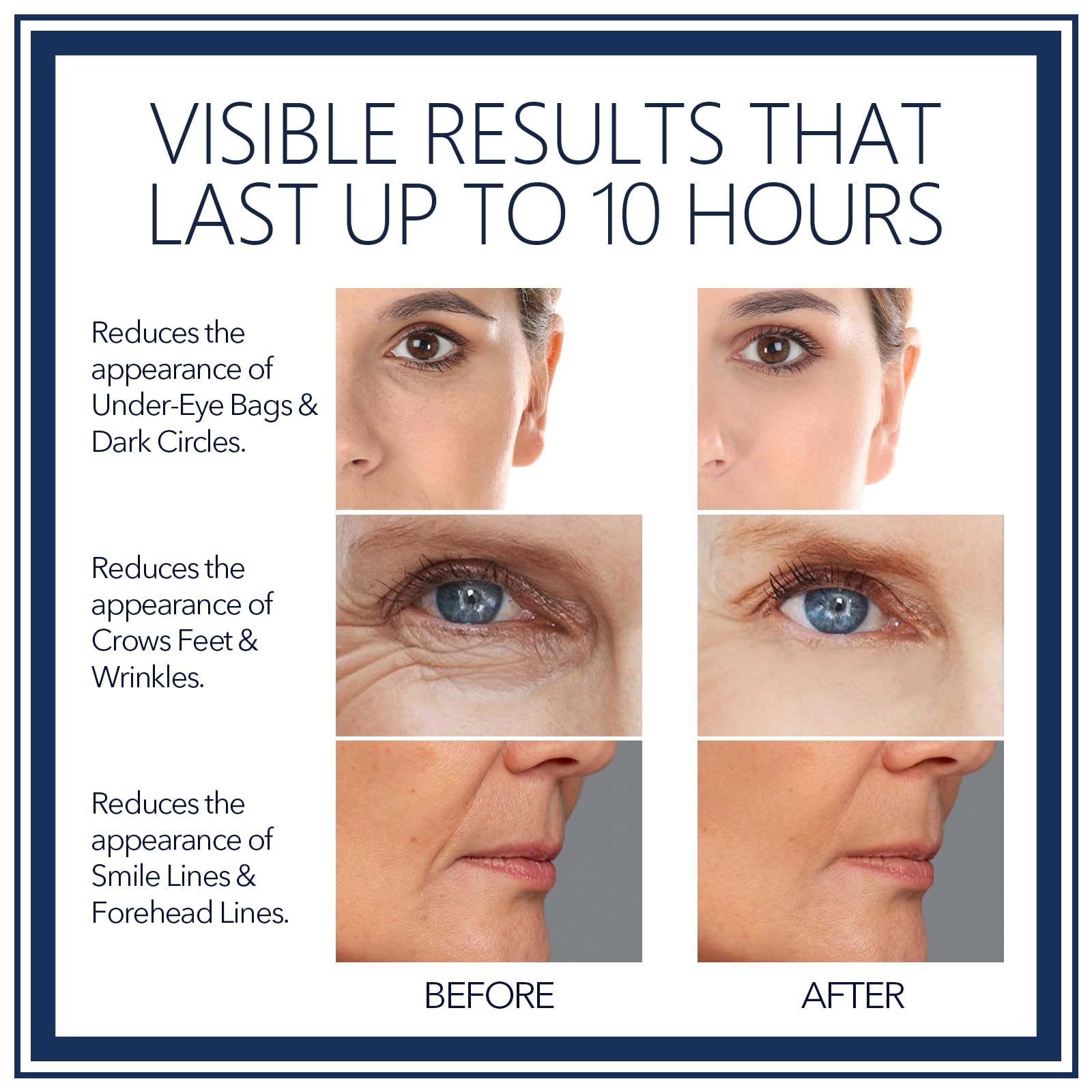 FZBYYLSRG eye serum's moisturizing texture hydrates the delicate skin around the eyes.