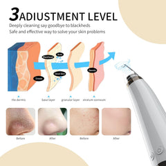 Gackoko Blackhead Remover portable design fits travel routines.