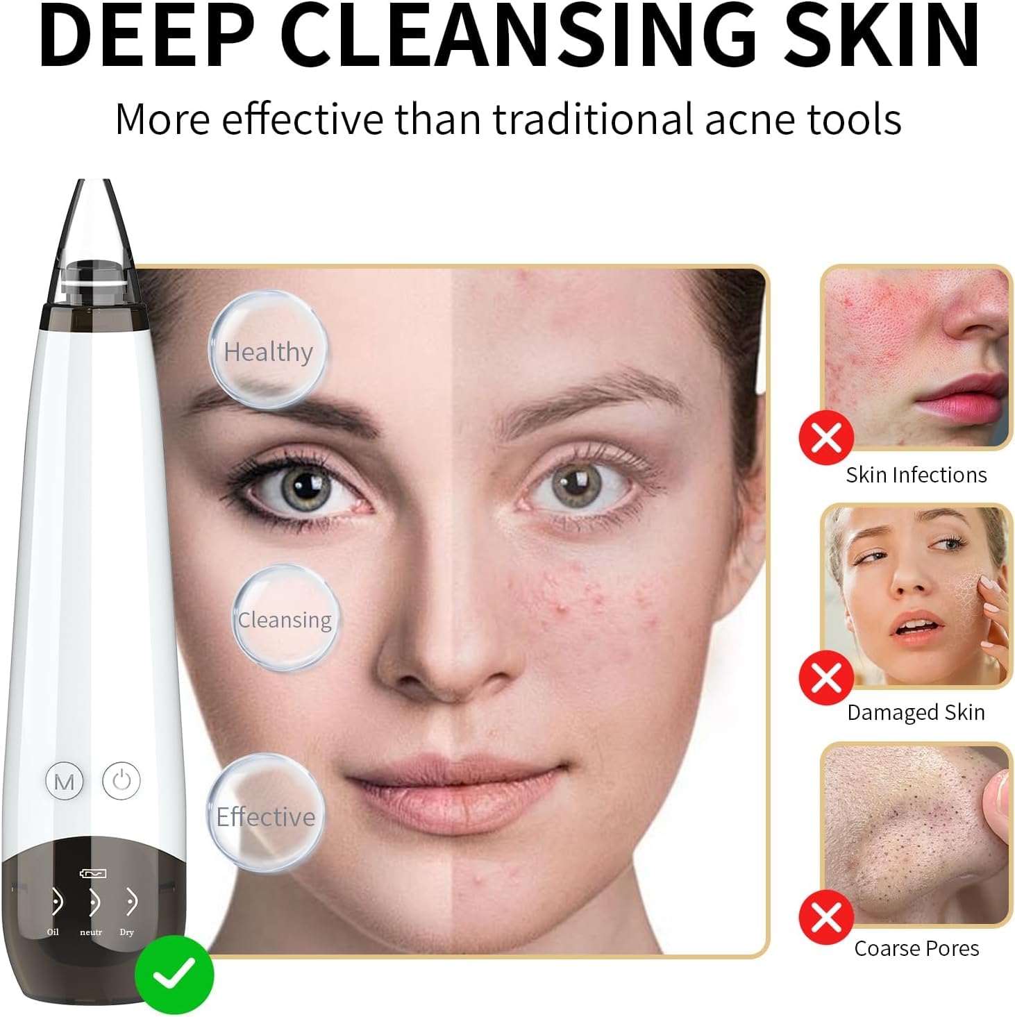 Gackoko Blackhead Remover soft silicone probes safely extract impurities with gentle contact.