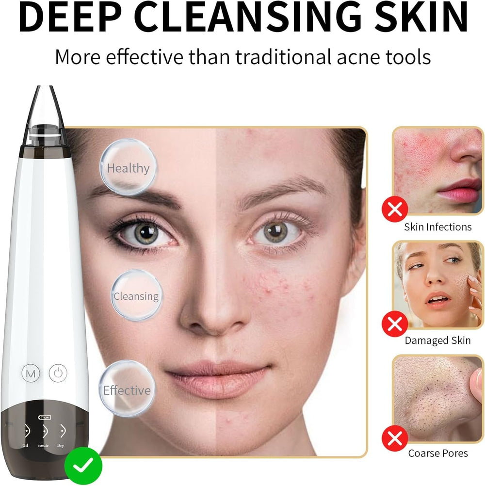 Gackoko Blackhead Remover soft silicone probes safely extract impurities with gentle contact.