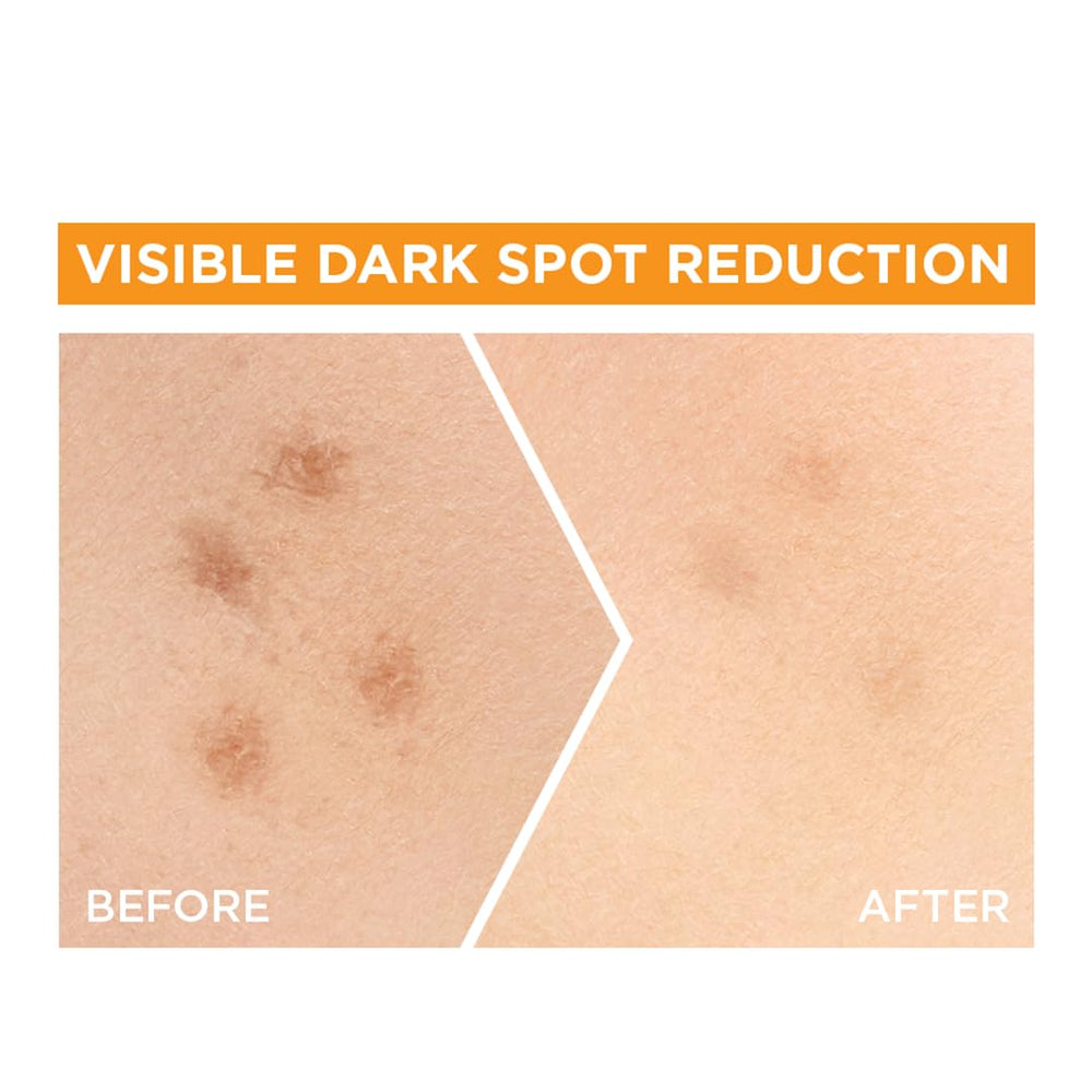 Garnier Bright Complete Vitamin C Booster with salicylic acid highlight for gentle exfoliation