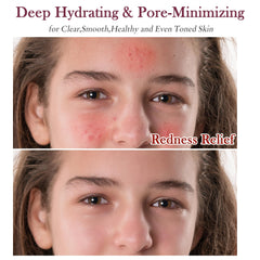 GEBEATY serum dropper delivers hydrating glow and smoothing effects.