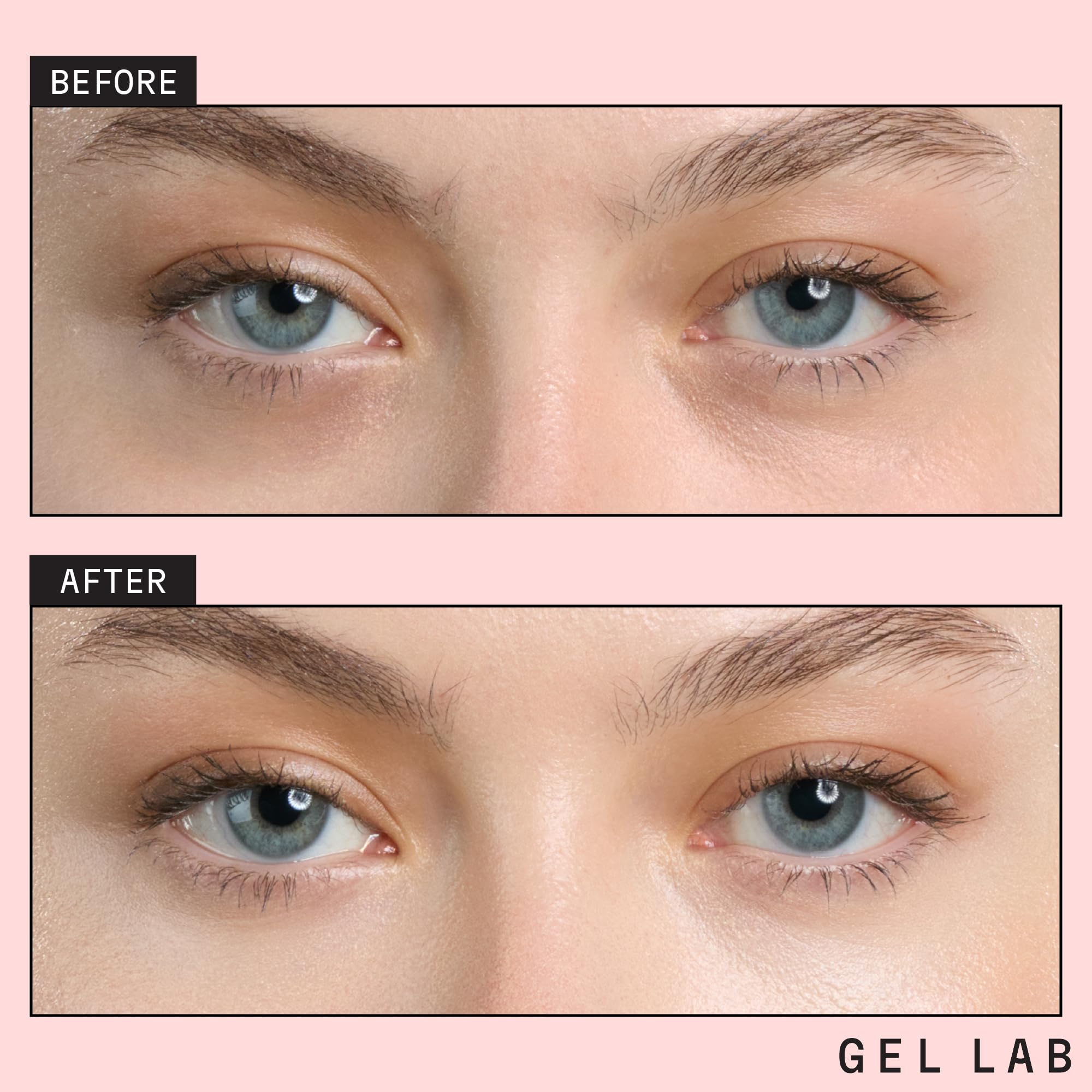 Gel Lab RENEW patches texture detail showcases hydrogel comfort during wear.
