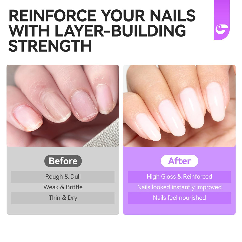 Gelike EC daily-use scenario improves nail resilience