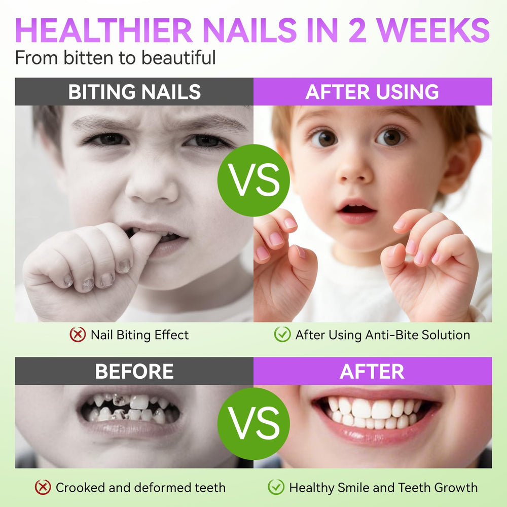 Gelike ec Nail Biting Treatment bottle close-up shows clear, odorless formula