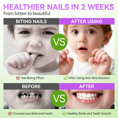 Gelike ec Nail Biting Treatment bottle close-up shows clear, odorless formula